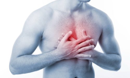 Диагностирование и лечение ишемической болезни сердца
