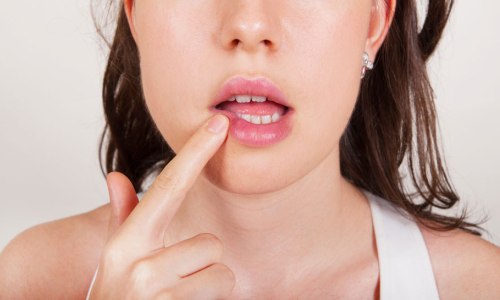 Яке лікування необхідно при алергії на губах?