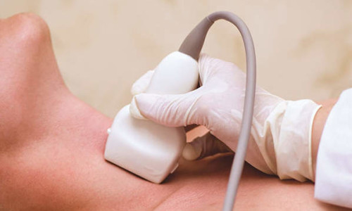 Підготовка та проведення УЗД щитовидної залози