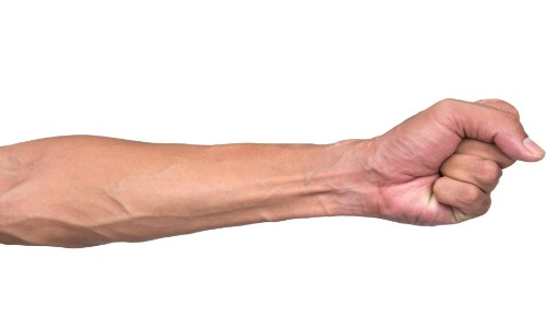 Методи лікування флебіту вени на руці
